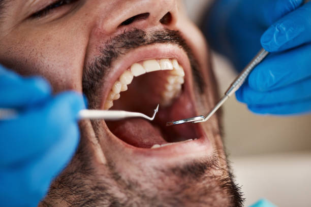 Best Cracked Tooth Emergency Dentist  in Dexter, MO